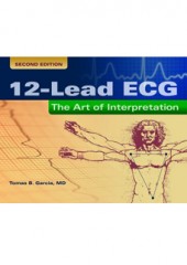 12-lead ECG: The Art of Interpretation, 2/e