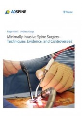 Minimally Invasive Spine Surgery: Techniques, Evidence, and Controversies 