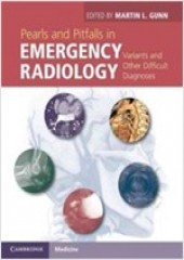 Pearls and Pitfalls in Emergency Radiology: Variants and Other Difficult Diagnoses 