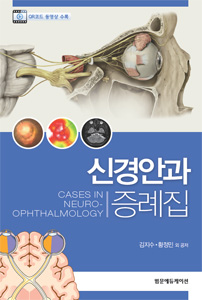 신경안과증례집 Cases in Neuro-ophthalmology