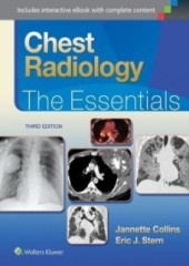 Chest Radiology: The Essentials, 3/e