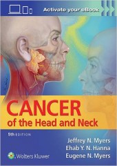 Cancer of the Head and Neck, 5/e