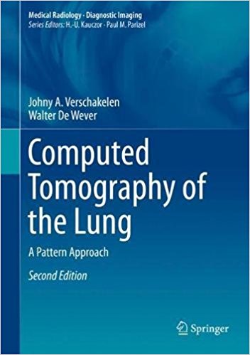 Computed Tomography of the Lung:A Pattern Approach, 2/e