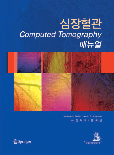 심장혈관 Computed Tomography 매뉴얼 Handbook of Cardiovascular CT