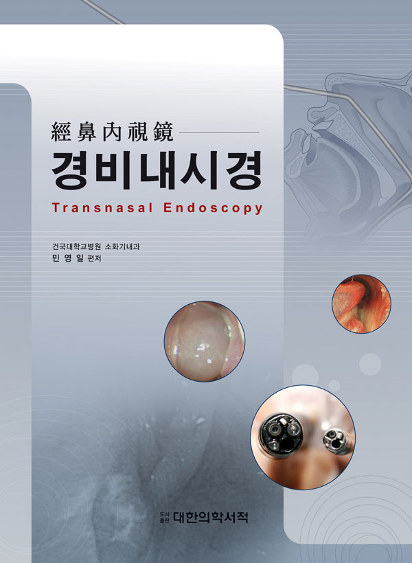경비내시경 Transnasal Endoscopy