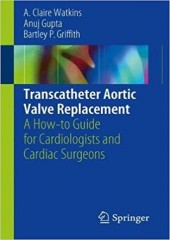 Transcatheter Aortic Valve Replacement: A How-to Guide for Cardiologists and Cardiac Surgeons 