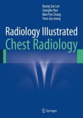 Radiology Illustrated:Chest Radiology