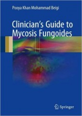 Clinician's Guide to Mycosis Fungoides