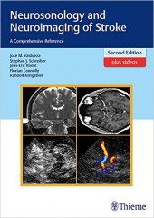 Neurosonology and Neuroimaging of Stroke: A Comprehensive Reference , 2/e