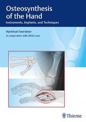 Osteosynthesis of the Hand: Instruments, Implants, and Techniques