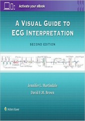 A Visual Guide to ECG Interpretation, 2/e