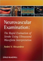 Neurovascular Ultrasound Examination and Waveform Interpretation