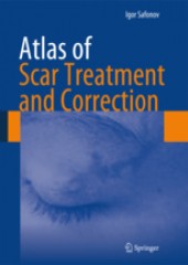 Atlas of Scar Treatment and Correction