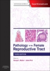 Pathology of the Female Reproductive Tract, 3/e