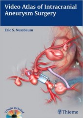 Video Atlas of Intracranial Aneurysm Surgery 