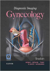 Diagnostic Imaging : Gynecology, 2/e
