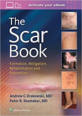 The Scar Book: Scar Formation, Rehabilitation, and Prevention