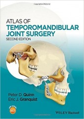 Atlas of Temporomandibular Joint Surgery , 2/e