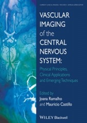 Vascular Imaging of the Central Nervous System: Physical Principles, Clinical Applications and Emerging Techniques