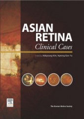 Asian Retina(Clinical Cases) 