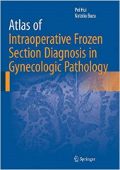 Atlas of Intraoperative Frozen Section Diagnosis in Gynecologic Pathology 